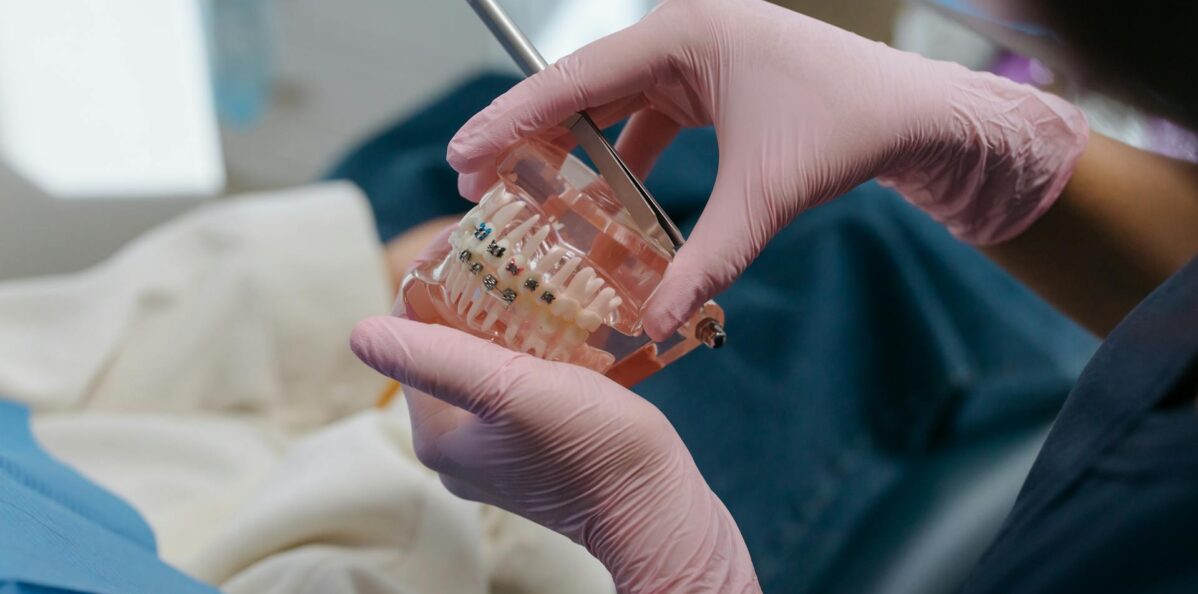 Does CDCP Covers Orthodontics