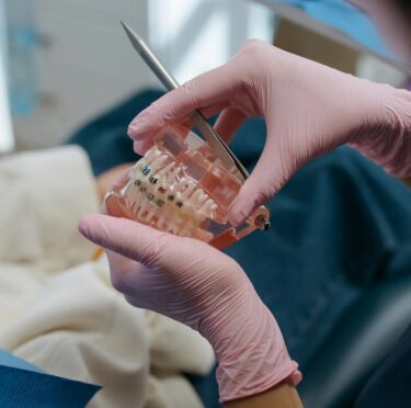 Does CDCP Covers Orthodontics